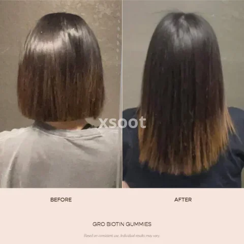 Buy GRO Biotin Gummies for Thinning Hair - Support Growth