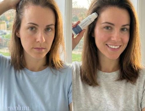 Buy Newplum Advanced Hair Growth Roll-On Serum Online
